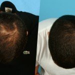 What are fruits and vegetables that don’t need to be refrigerated?