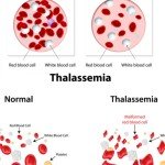 Top 10 Ways to Protect Yourself From Smog in Winter