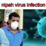 Benefits of amla and how to make amla achar?