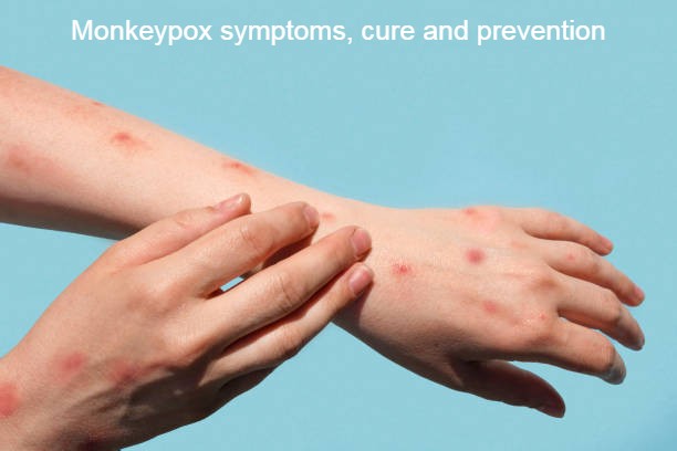 Everything You Should Know About Monkeypox