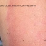 Want Frizz Free Locks! Try These 5 Homemade DIY Hair Masks